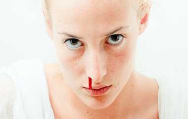 Nose Bleeding: மூக்கில் இருந்து இரத்தம் வழிந்தால் என்ன செய்ய வேண்டும்?.. பதற்றத்திலும் நிதானம் வேண்டும்.!