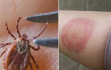 Lyme Disease: கேரளாவில் உறுதியானது பூச்சிகளால் பரவும் லைம் நோய்: மரணமும் ஏற்பட வாய்ப்பு..!